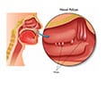 North texas sinus, p.a.