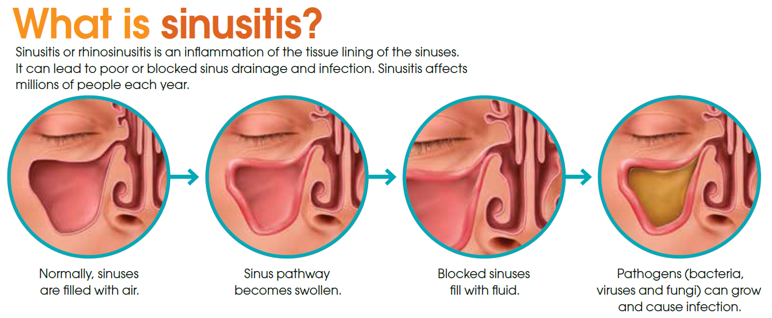 North texas sinus, p.a.