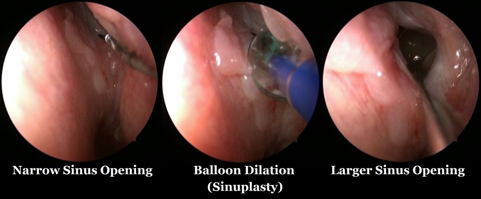 North texas sinus, p.a.